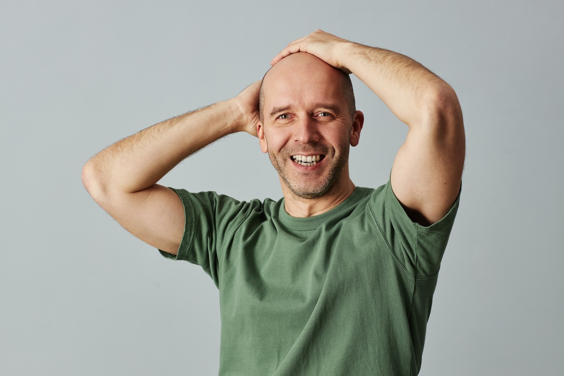 Can Bald be Beautiful?