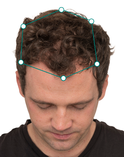 Nutrafol-Brain-after